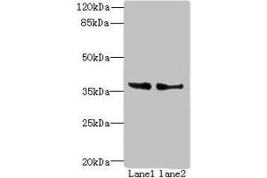 Western blot All lanes: POLR3F antibody at 8 μg/mL Lane 1: Hela whole cell lysate Lane 2: HepG2 whole cell lysate Secondary Goat polyclonal to rabbit IgG at 1/10000 dilution Predicted band size: 36 kDa Observed band size: 36 kDa (POLR3F 抗体  (AA 1-270))