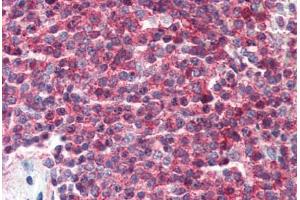 Human Spleen (formalin-fixed, paraffin-embedded) stained with CD27 antibody ABIN396917 at 10 ug/ml followed by biotinylated secondary antibody, alkaline phosphatase-streptavidin and chromogen. (CD27 抗体  (FITC))