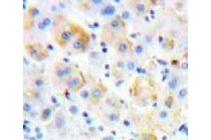 Used in DAB staining on fromalin fixed paraffin-embedded Liver tissue (P-Selectin 抗体  (AA 58-259))