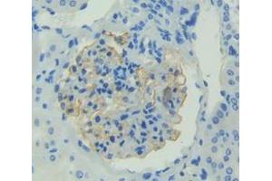 IHC-P analysis of Human Tissue, with DAB staining. (FGF1 抗体  (AA 1-155))