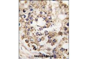 Formalin-fixed and paraffin-embedded human testis tissue reacted with PDX1 Antibody (N-term) (ABIN392140 and ABIN2841872) , which was peroxidase-conjugated to the secondary antibody, followed by DAB staining. (PDX1 抗体  (N-Term))