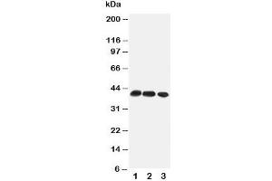 Western blot testing of CCR4 antibody and Lane 1:  mouse thymus;  2: mouse spleen;  3: (m) HEPA cell lysate (CCR4 抗体  (Middle Region))