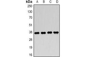 Western blot analysis of LDHA expression in MCF7 (A), Jurkat (B), NIH3T3 (C), mouse skeletal muscle (D) whole cell lysates. (Lactate Dehydrogenase A 抗体)