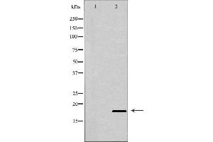 Western blot analysis of extracts of Raji , using BIK antibody. (BIK 抗体  (N-Term))