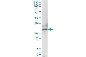 Immunoprecipitation of DCK transfected lysate using rabbit polyclonal anti-DCK and Protein A Magnetic Bead
