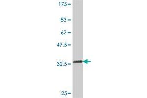 Western Blot detection against Immunogen (37 KDa) . (ELP4 抗体  (AA 101-199))