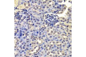 Immunohistochemistry of paraffin-embedded mouse kidney using LSM4 antibody. (LSM4 抗体  (AA 1-139))