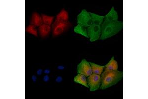 ABIN6258226 and ABIN6273945 staining  cells by IF/ICC. (GRPR 抗体  (Internal Region))
