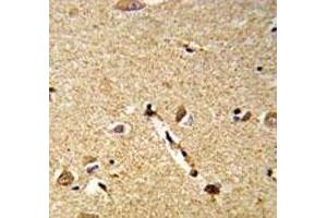 Immunohistochemistry (IHC) image for anti-delta Like Protein 3 (DLL3) (AA 519-548) antibody (ABIN3028609)