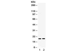 Western blot testing of 1) mouse ovary and 2) mouse HEPA lysate with IP10 antibody. (CXCL10 抗体  (AA 22-98))