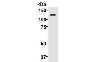 Western Blotting (WB) image for anti-Kinesin Family Member 11 (KIF11) (AA 1-1056), (N-Term) antibody (ABIN1449288) (KIF11 抗体  (N-Term))
