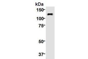 Western Blotting (WB) image for anti-Kinesin Family Member 11 (KIF11) (AA 1-1056), (N-Term) antibody (ABIN1449288)