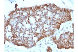 Immunohistochemistry (IHC) image for anti-Estrogen Receptor 2 (ESR2) (C-Term) antibody (ABIN6939350)
