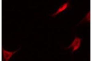 ABIN6275629 staining Hela by IF/ICC. (Thrombomodulin 抗体  (C-Term))