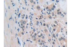 Immunohistochemistry (IHC) image for anti-Nucleoporin 50kDa (NUP50) (AA 37-269) antibody (ABIN7442900)