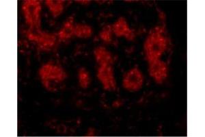 Immunofluorescence of TRIM5 alpha in human breast tissue with this product at 10 μg/ml. (TRIM5 抗体  (C-Term, Isoform alpha))