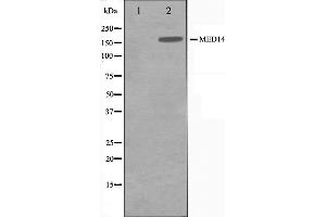 Western blot analysis of MED14 Antibody expression in Hela cells lysates. (MED14 抗体  (Internal Region))