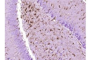Paraformaldehyde-fixed, paraffin embedded rat brain Antigen retrieval by boiling in sodium citrate buffer (pH6.