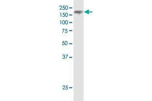 NPC1 monoclonal antibody (M02), clone 4H2. (NPC1 抗体  (AA 151-250))