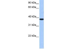 WB Suggested Anti-MEIS1 Antibody Titration:  0. (MEIS1 抗体  (C-Term))