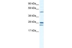 Western Blotting (WB) image for anti-Gap Junction Protein, beta 2, 26kDa (GJB2) antibody (ABIN2461384) (GJB2 抗体)
