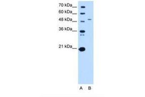 Image no. 2 for anti-serine Palmitoyltransferase, Long Chain Base Subunit 1 (SPTLC1) (AA 254-303) antibody (ABIN6738265) (SPTLC1 抗体  (AA 254-303))