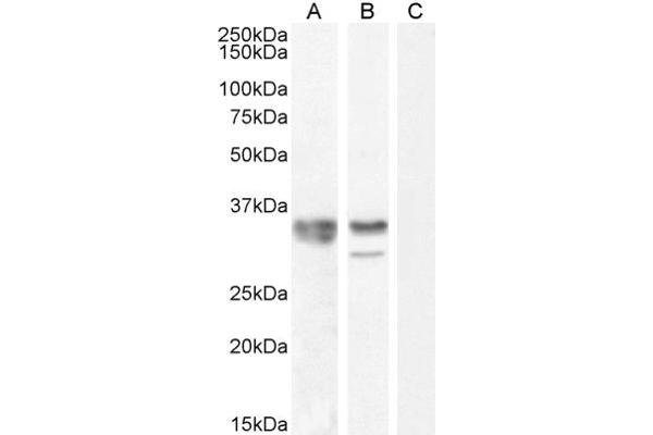 HNRNPA2B1 抗体  (Internal Region)