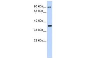 Image no. 1 for anti-Inhibitor of kappa Light Polypeptide Gene Enhancer in B-Cells, Kinase beta (IKBKB) (AA 215-264) antibody (ABIN6742299)