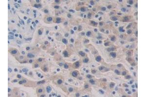 Immunohistochemistry (IHC) image for anti-HAUS Augmin-Like Complex, Subunit 7 (HAUS7) (AA 4-319) antibody (ABIN1171746)