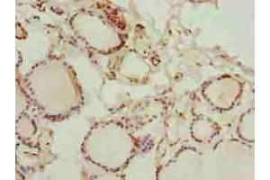 Immunohistochemistry of paraffin-embedded human thyroid tissue using ABIN7154238 at dilution of 1:100 (GLT1D1 抗体  (AA 17-152))
