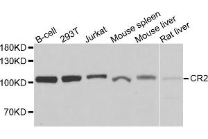 Western blot analysis of extracts of various cell lines, using CR2 antibody. (CD21 抗体)