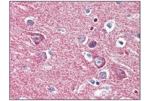 Immunohistochemistry (IHC) image for anti-Hexokinase 1 (HK1) (AA 1-917), (N-Term) antibody (ABIN317095) (Hexokinase 1 抗体  (N-Term))