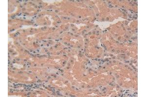Immunohistochemistry (IHC) image for anti-Actin, alpha 2, Smooth Muscle, Aorta (ACTA2) (AA 167-377) antibody (ABIN7439306)