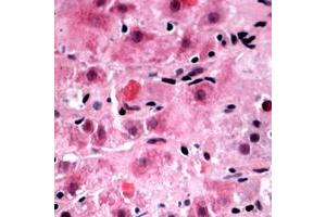 Immunohistochemical analysis of RPL39 staining in human liver formalin fixed paraffin embedded tissue section. (RPL39 抗体  (N-Term))