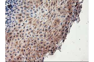 Immunohistochemical staining of paraffin-embedded Human tonsil using anti-ACSS2 mouse monoclonal antibody. (ACSS2 抗体)