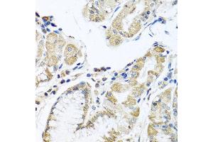 Immunohistochemistry of paraffin-embedded human stomach using IFNL3 antibody at dilution of 1:100 (40x lens). (IL28B 抗体)