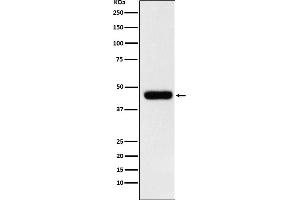 Western Blotting (WB) image for anti-Eukaryotic Translation Initiation Factor 4A1 (EIF4A1) antibody (ABIN7606784)