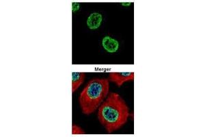 ICC/IF Image Confocal immunofluorescence analysis (Olympus FV10i) of paraformaldehyde-fixed A431, using Histone H2A. (H2AFZ 抗体  (N-Term))
