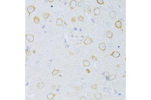 Immunohistochemistry of paraffin-embedded rat brain using CD63 antibody (ABIN5974980) at dilution of 1/100 (40x lens). (CD63 抗体)