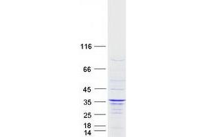 Validation with Western Blot