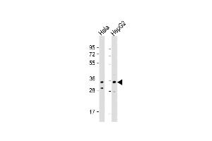 All lanes : Anti-I Antibody (C-term) at 1:1000 dilution Lane 1: Hela whole cell lysate Lane 2: HepG2 whole cell lysate Lysates/proteins at 20 μg per lane. (IMP4 抗体  (C-Term))