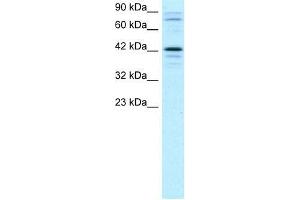 Human Jurkat; WB Suggested Anti-SOX18 Antibody Titration: 2. (SOX18 抗体  (Middle Region))