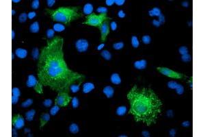 Anti-KATNB1 mouse monoclonal antibody (ABIN2455206) immunofluorescent staining of COS7 cells transiently transfected by pCMV6-ENTRY KATNB1 (RC201852). (KATNB1 抗体)