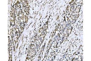 IHC analysis of PC4/SUB1 using anti-PC4/SUB1 antibody (ABIN7602184).