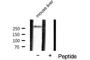 Western blot analysis of mTOR phosphorylation expression in mouse liver tissue lysates,The lane on the right is treated with the antigen-specific peptide. (MTOR 抗体  (pSer2448))