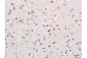 Formalin-fixed and paraffin embedded rat brain labeled with Rabbit Anti RBBP5 Polyclonal Antibody, Unconjugated  at 1:200 followed by conjugation to the secondary antibody and DAB staining (RBBP5 抗体  (AA 131-230))
