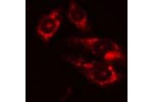 ABIN6274207 staining Hela cells by IF/ICC. (DTYMK 抗体  (Internal Region))