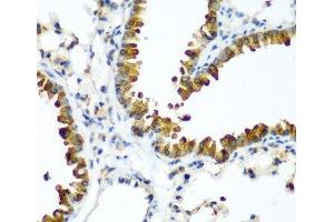 Immunohistochemistry of paraffin-embedded Mouse lung using TAZ Polyclonal Antibody at dilution of 1:200 (40x lens). (TAZ 抗体)