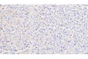 Detection of IFNg in Canine Liver Tissue using Polyclonal Antibody to Interferon Gamma (IFNg) (Interferon gamma 抗体  (AA 24-166))