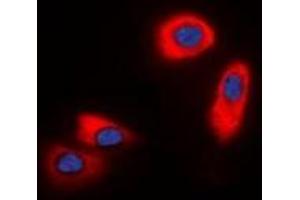 Immunofluorescent analysis of CHST9 staining in HepG2 cells. (CHST9 抗体  (C-Term))
